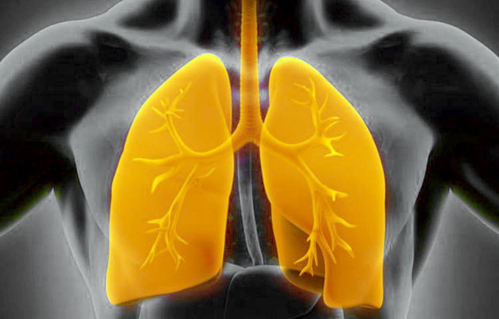 Deficiencia de AAT ocasiona enfermedades pulmonares El Deficiencia de AAT ocasiona enfermedades pulmonares El