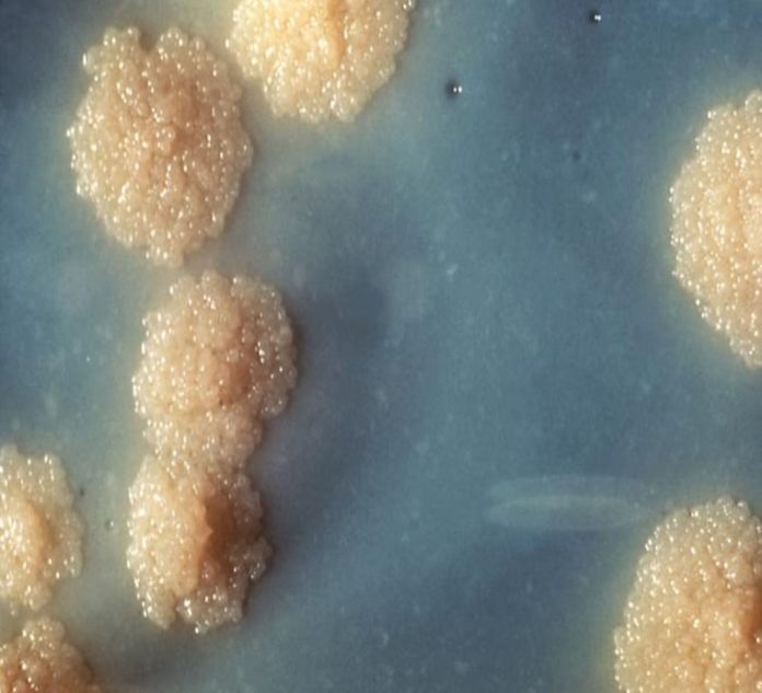 mex tuberculosis jpg