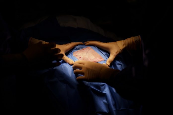 Los CDC emiten alerta por posibles casos de meningitis fúngica tras cirugías en México